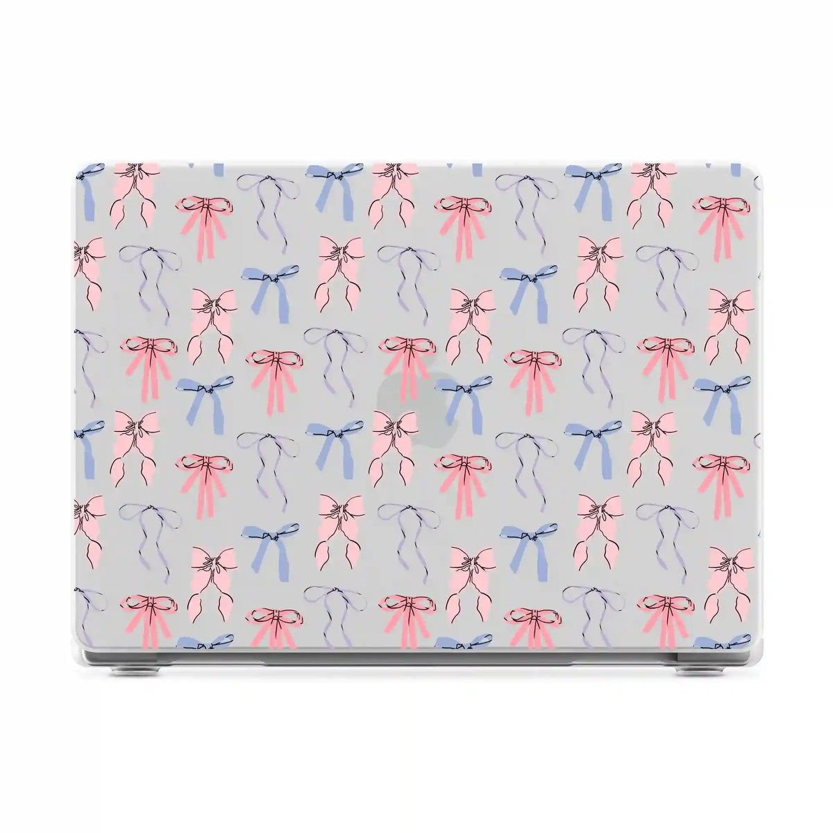 Coquette Girlie | Pastel Bows Laptop Shell