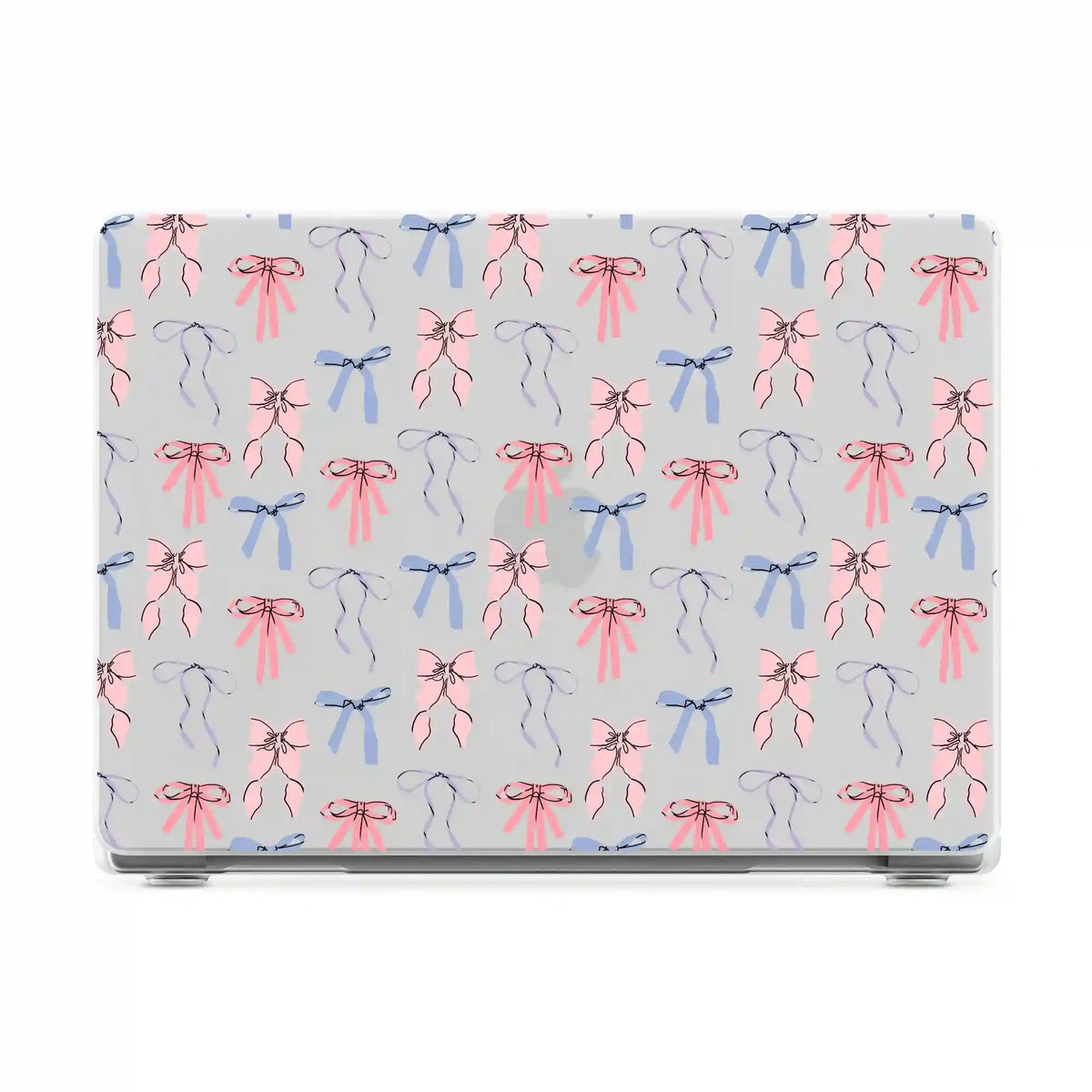 Coquette Girlie | Pastel Bows Laptop Shell